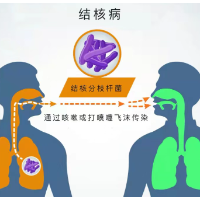 第29个世界防治结核病日——你我共同努力 终结结核流行