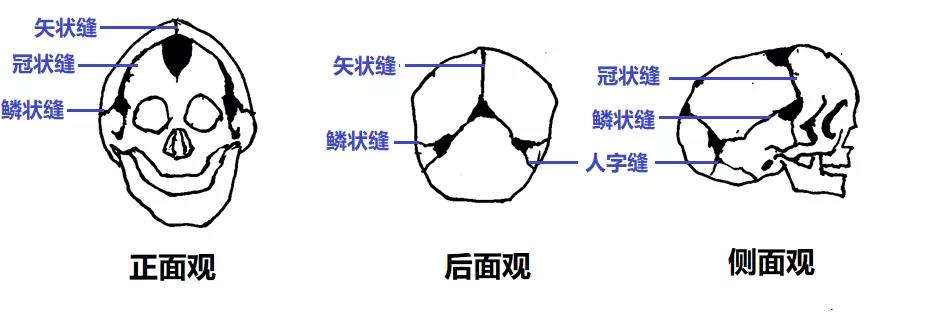 中国预防出生缺陷日 天生"三角形"脑袋,这是什么怪病?