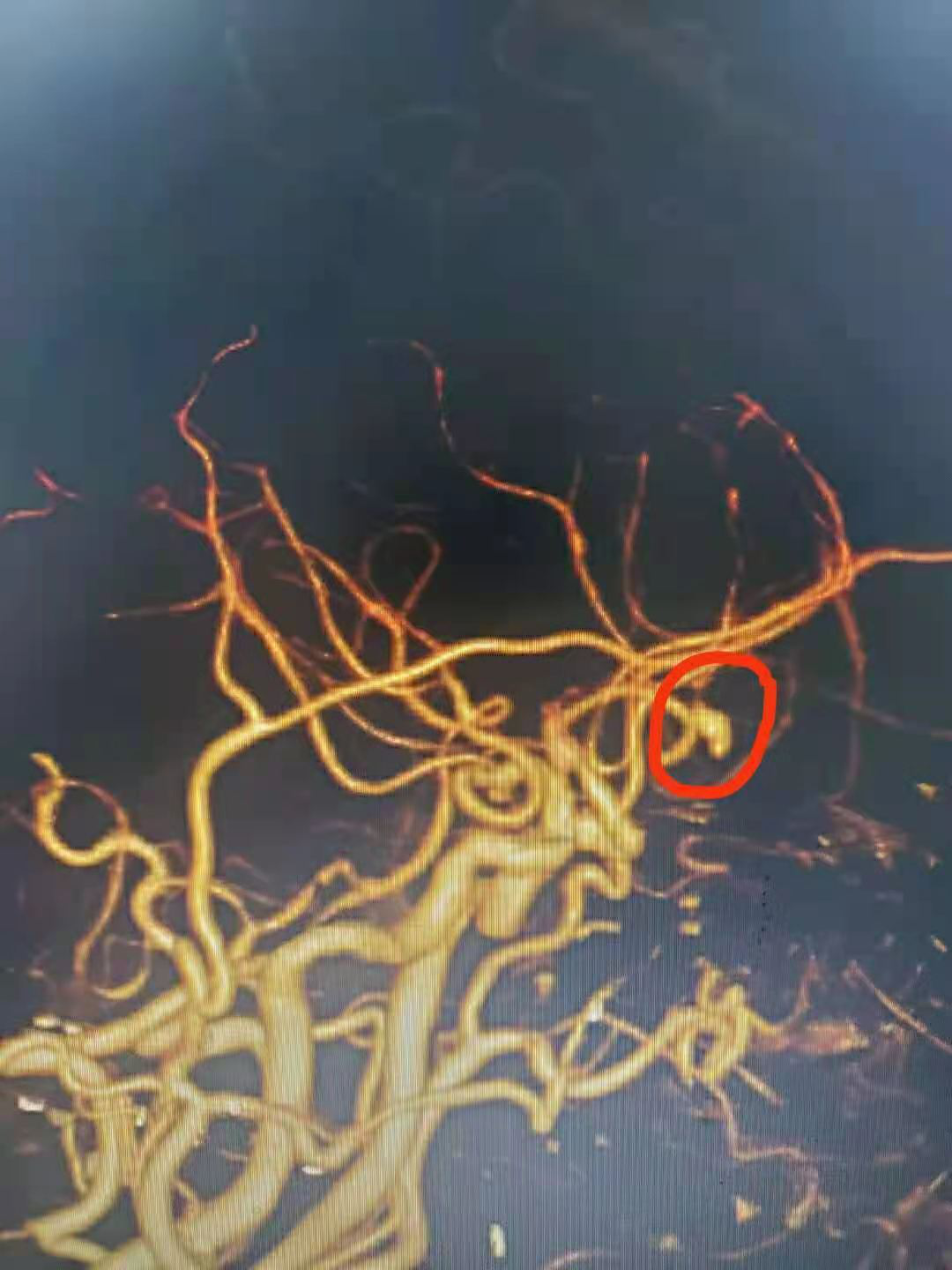 17.png