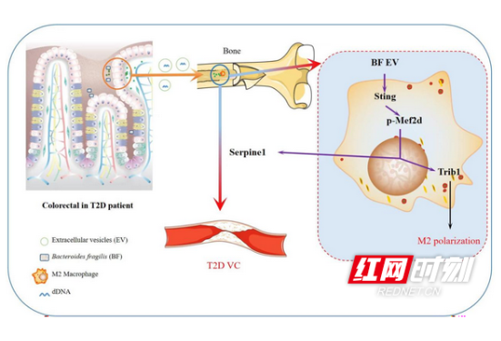 1天2篇！南华大学附属第一医院刘江华教授团队在Advanced Science发表最新研究成果