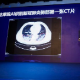 中国科技馆收录数字抗疫藏品 阿里达摩院首张AI识别新冠CT入选