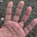 连做核酸检测八小时的手