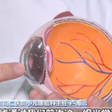“近视焦虑”的坎儿家长们该如何过？这些知识点了解一下