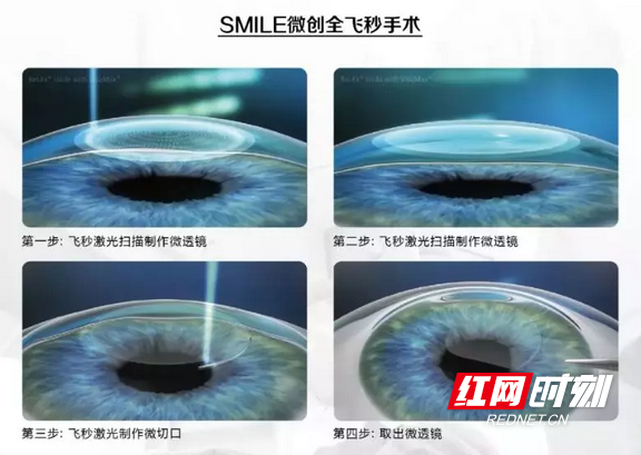 图片1.wm.png 图片1.wm.png