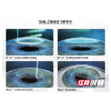 Smile摘镜大揭秘!新生变美从这里开始……