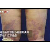 湘籍女歌手整容失败索赔120万，医院：人还没死，100多万元是随便给的？