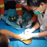 男子戒指“咬手”3天 桃江消防一分钟成功“剪”救