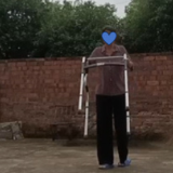医疗服务提升年丨永州市中心医院：十年 “石臼” 锁双髋 分步手术助患者重踏 “希望路”