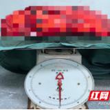 医疗服务提升年丨永州市中心医院：多学科协作 成功切除腹膜后巨大肿瘤