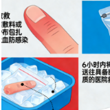 医疗服务提升年丨妙手护航 警钟长鸣 永州市中医医院手足踝骨科发出防范手足外伤安全提醒