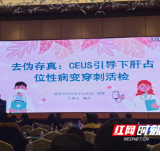 永州市中心医院超声介入团队在省赛中斩获佳绩