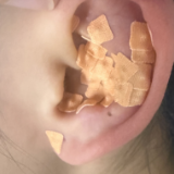 永州市中医医院：中医辨证施治+非遗耳穴疗法 解锁护颈新妙招