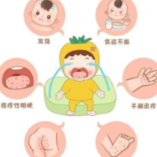 @永州家长 手足口病进入高发期，这份“防病五招”请收好！