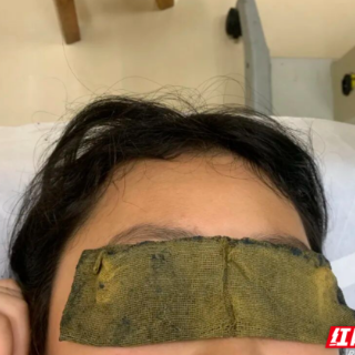 科普专栏 | 视神经萎缩:被悄悄偷走的光明,中医守护光明有妙招!