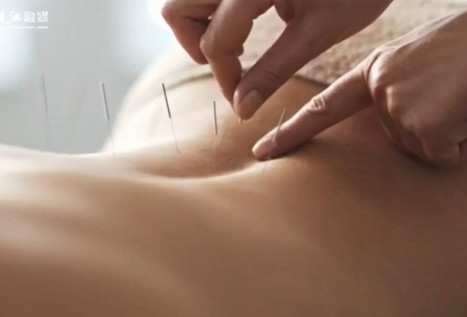 湘江追光人丨我在非洲传授“针”功夫