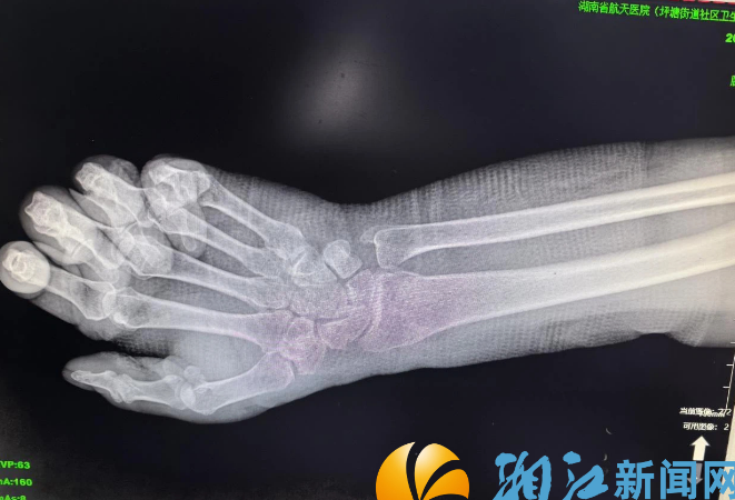 强基固本显成效，中医正骨解民忧