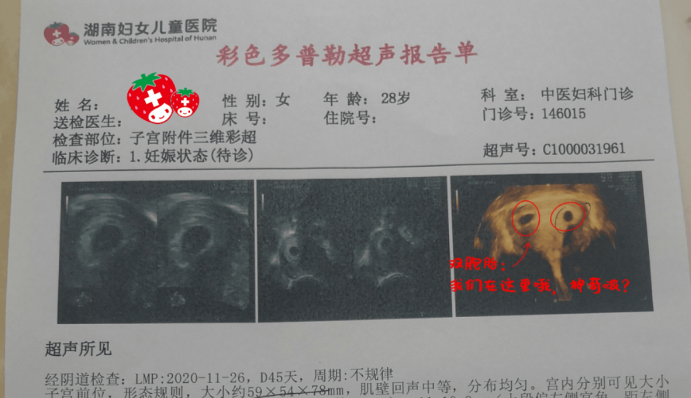 两个孕囊在超声下清晰可见,意味着赵女士子喜怀双胞胎