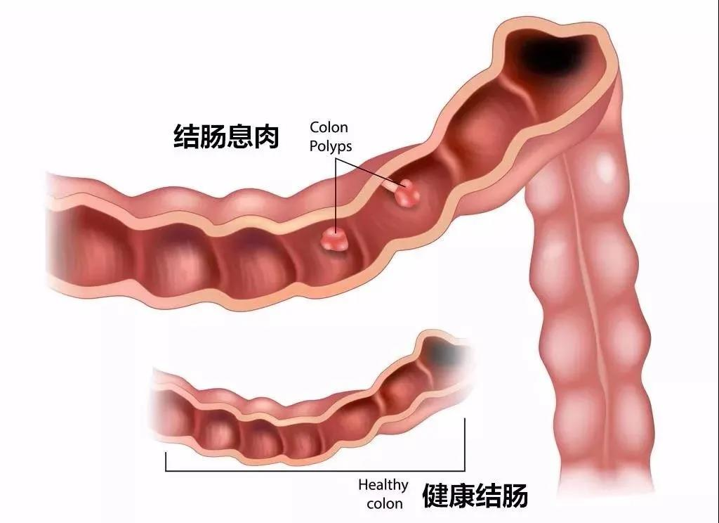 形状1.png