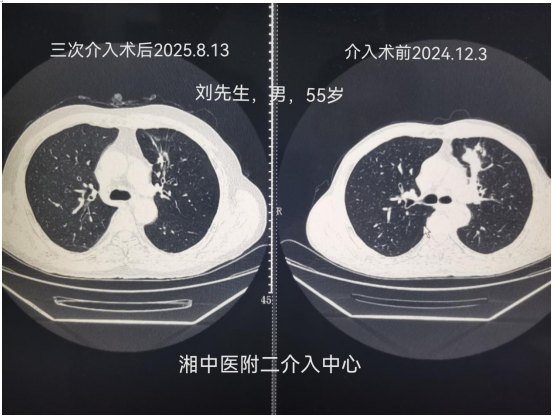 未命名1755840678.png