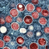 美国纽约州就猴痘疫情发布灾难声明