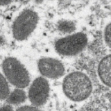 全球累计猴痘确诊病例超5万例