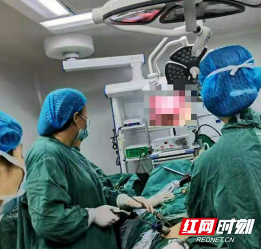 郴州市妇幼保健院成功实施腹腔镜下巨大子宫肌瘤剥除术