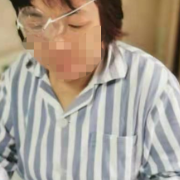 1600度高度近视患者戴镜五十年接近失明 手术后直呼后悔