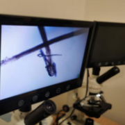 不正确的卸妆招来眼睛上蠕形螨虫?眼睛干痒的要注意!