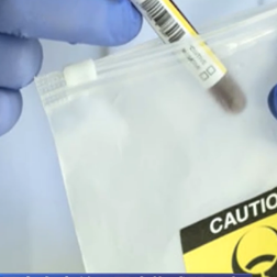 国际锐评|世卫组织的发声,再次让黑暗的美国在乌生物实验室曝光!