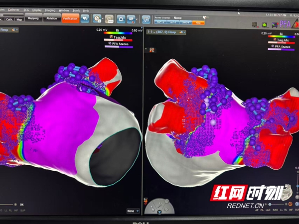 微信图片_20251210183820_28_1877.jpg 微信图片_20251210183820_28_1877.jpg