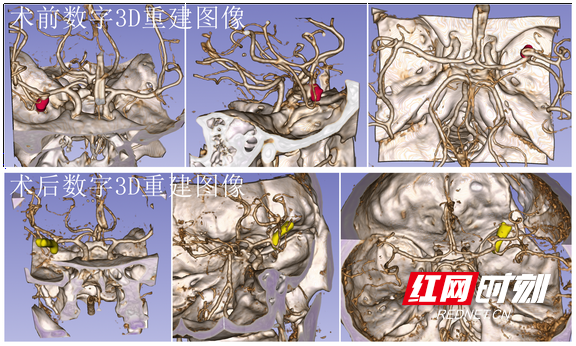 图片4.marked.png