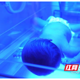 关于新生儿黄疸，家长一定得重视