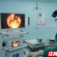 消灭鼾声内镜微创手术在湖南省妇幼保健院成功实施