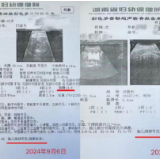 “调皮的生命线” 脐带绕颈5周宝宝在湖南省妇幼保健院平安出生