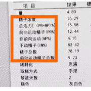 PR、NP、IM小蝌蚪是什么意思？这段视频告诉你答案