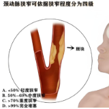 颈动脉斑块不痛不痒就不用管？这个错误认知差点让他瘫痪