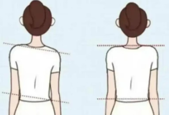 高低肩是侧睡导致的？别再冤枉你的睡姿了！