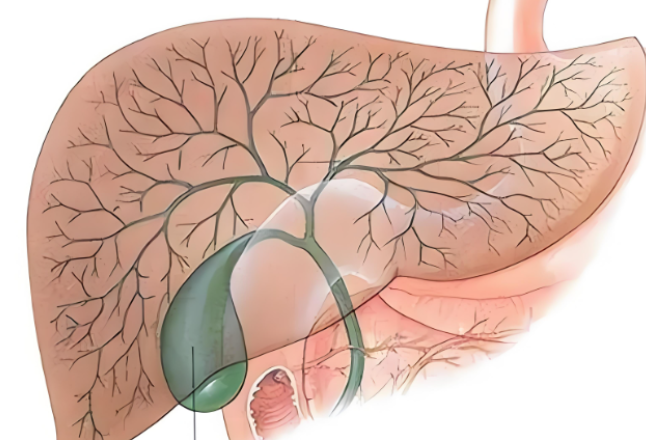胆囊炎只有中年以上的人才会得？