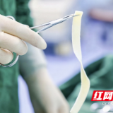 海南患者赴长沙就医 长沙普瑞医院3D生物束带助她解决问题