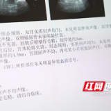长沙珂信肿瘤医院妇瘤科团队精准施治 助力宫颈癌患者摆脱剧痛
