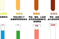 科普华容 | 早晨第一泡尿，可能是身体在“呼救”！这些信号千万别忽略