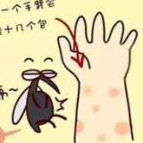 【健康科普】病媒生物，应该怎么防制？