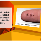 【健康与生活】蜱虫进入活跃期！外出游玩需做好防护措施