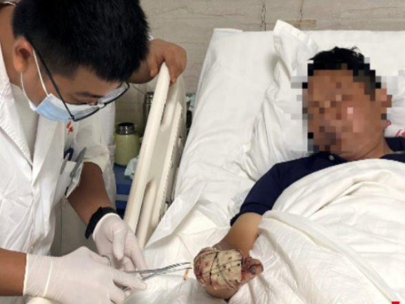 险遭截肢！保靖县中医院凭借显微技术攻坚克难，为重度右手毁损伤患者保全手部核心功能