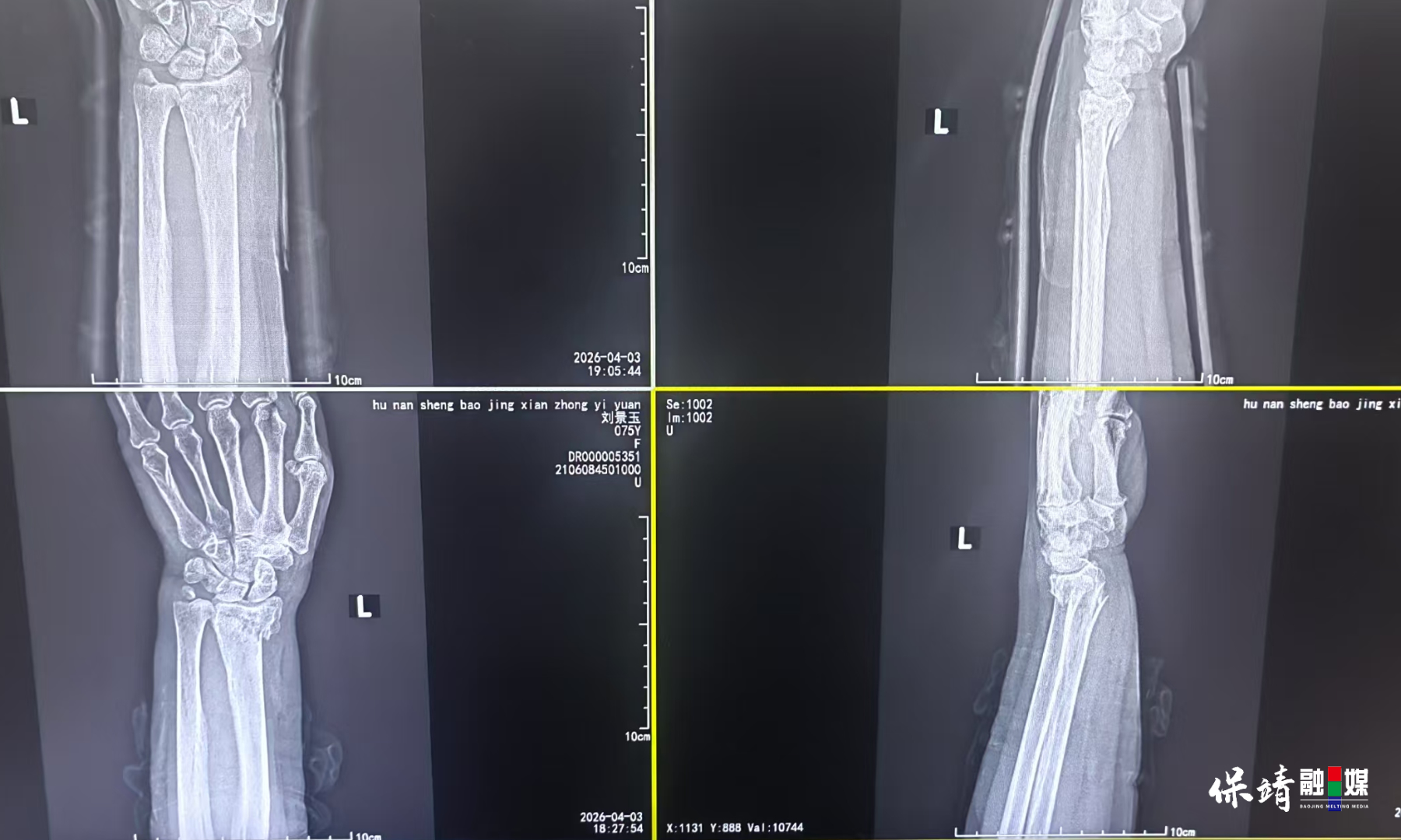 3月14日 (1)(272).jpg 3月14日 (1)(272).jpg