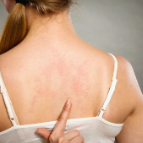 【健康渌口行动】麻疹、水痘、手足口病，什么时候最容易传染？很多人都搞错了！