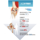 浏阳落地人工关节“集采价”平均降价超八成