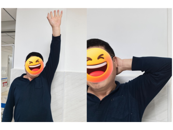 宁远县中医医院：开展肩关节水分离技术